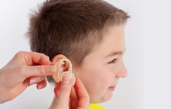 小儿外耳廓畸形验配助听器