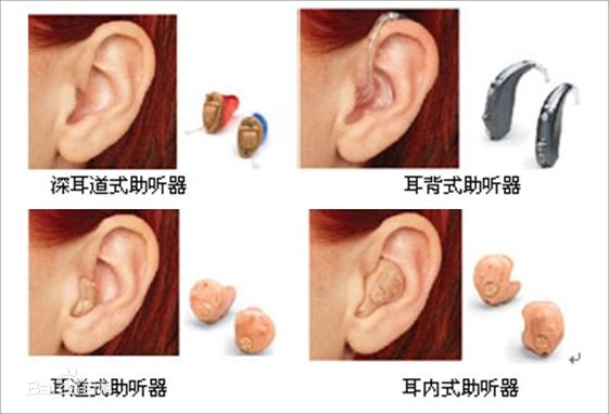 助听器的类型