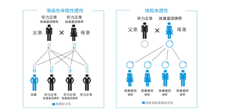 美国人工耳蜗