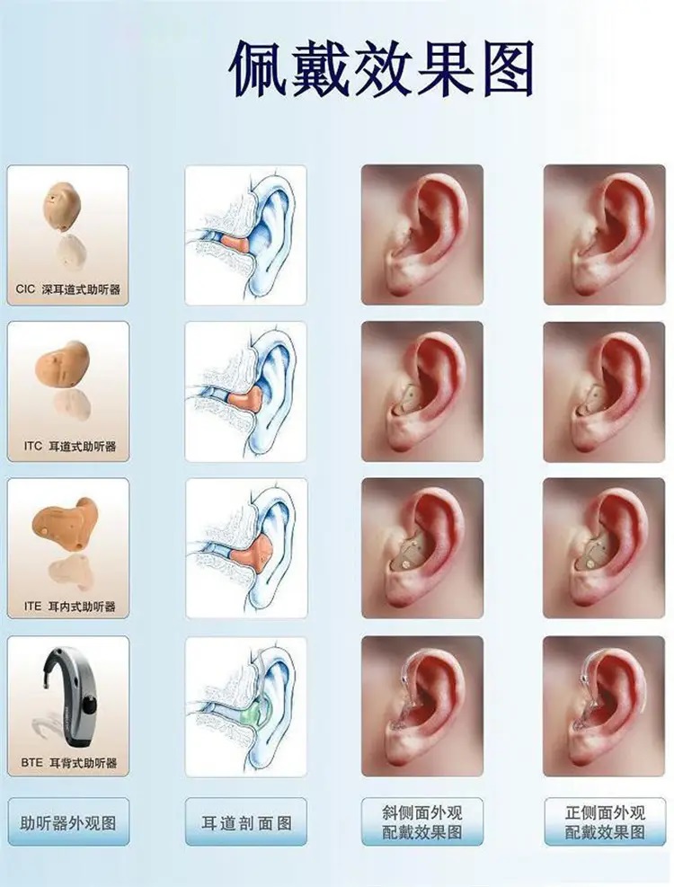 助听器的分类，如何选择